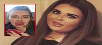 Six times larger lip? Disaster for the woman..!?